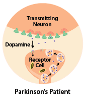 diagram of parkinsons